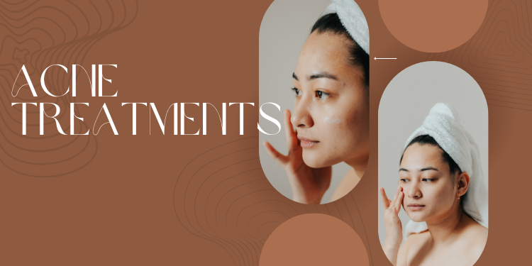 acne treatments